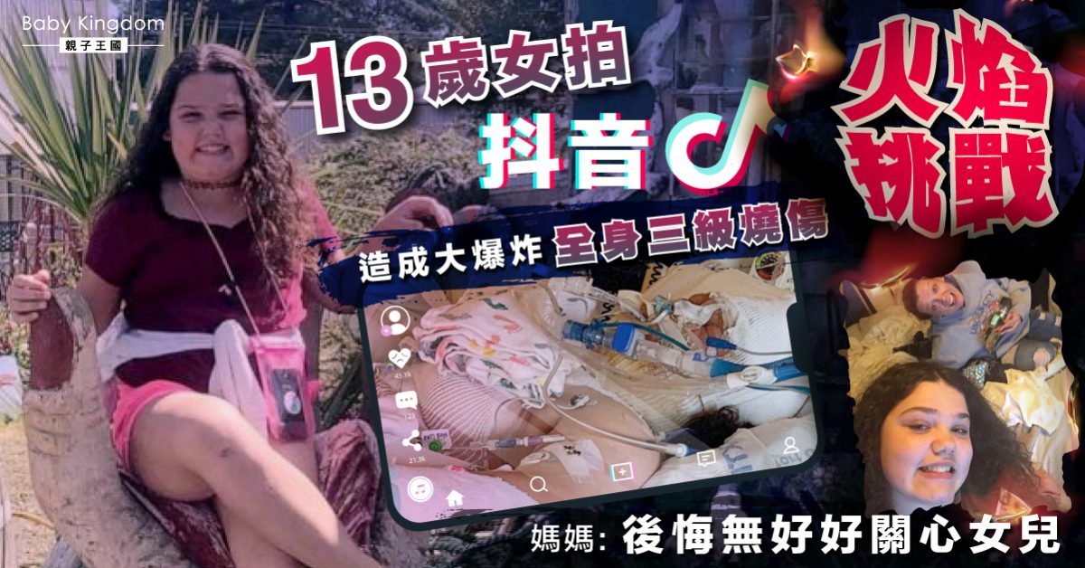 【家長注意】13歲女拍抖音「火焰挑戰」造成大爆炸 全身三級燒傷