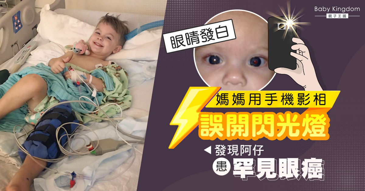 【家長注意】媽媽用手機影相誤開閃光燈 發現兒子患罕見眼癌