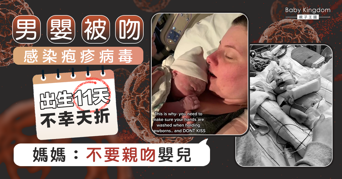 【新手媽媽注意】父母一吻變成「死亡之吻」 男嬰出生11天感染疱疹病毒不幸夭折