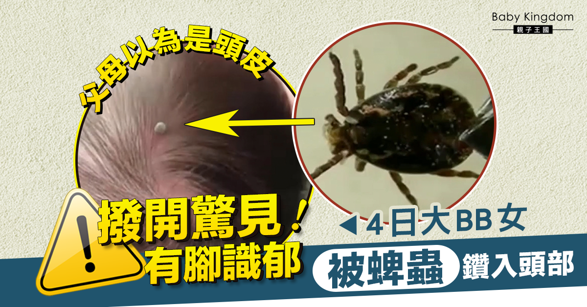 【慎入】4日大女嬰被蜱蟲咬傷 父母以為是頭皮 送院發現蜱蟲已鑽入頭部