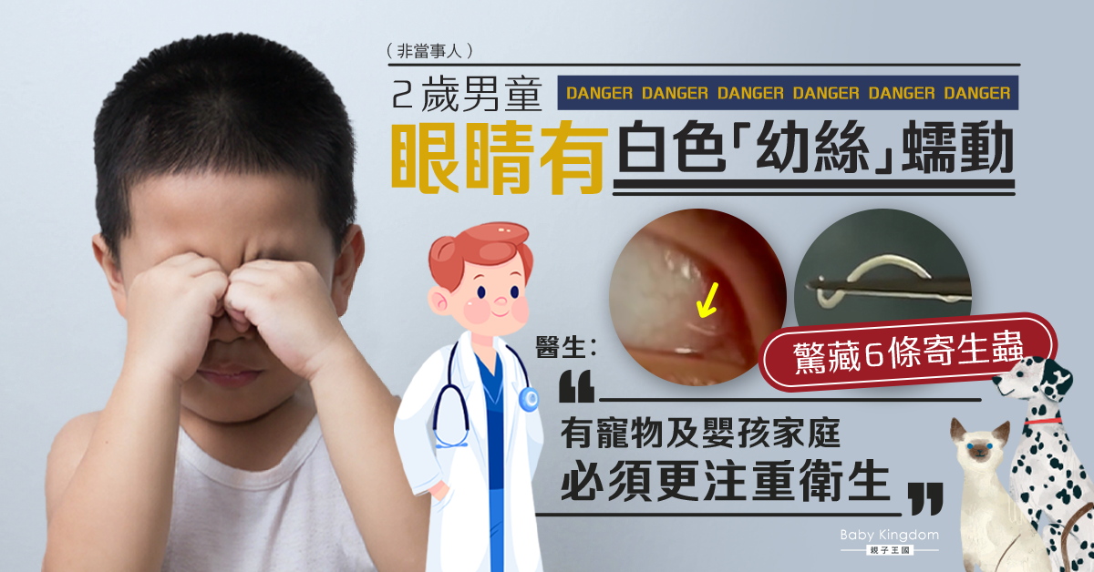 【兒童衛生】2歲男童眼睛藏6條寄生蟲 醫生指疑摸貓狗後無洗手揉眼引致
