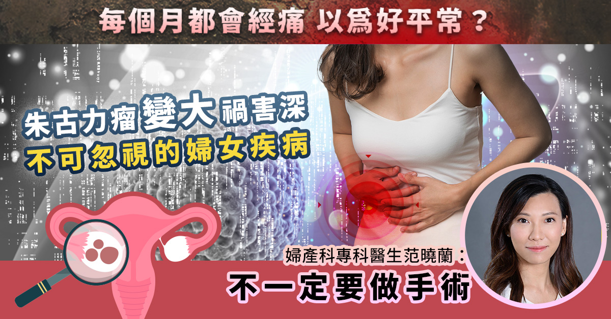 朱古力瘤變大禍害深 – 不可忽視的婦女疾病