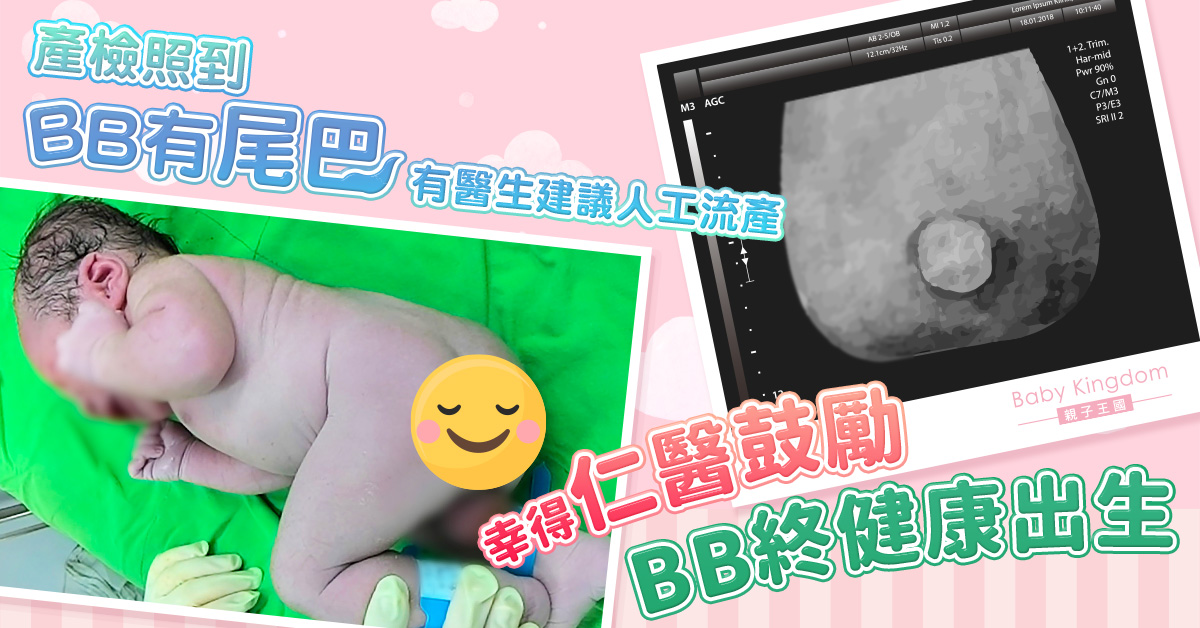 產檢發現BB有尾巴 仁醫兩大因素決定留人 孩子終健康成長