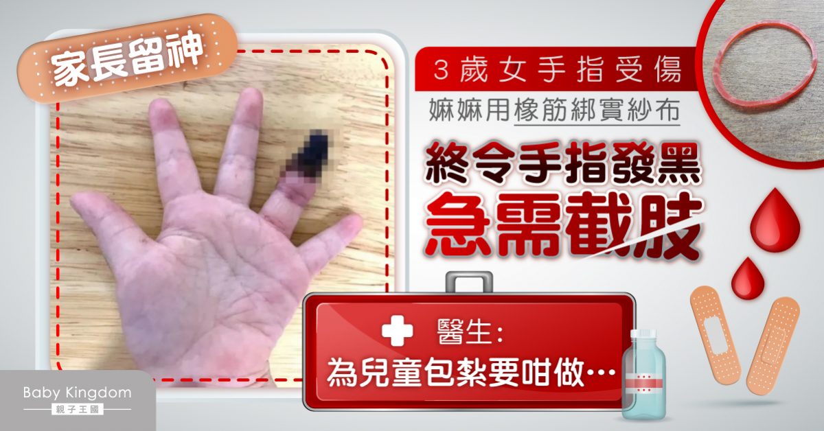 【家長留神】嫲嫲用橡筋為孫女包紮 終令手指壞死需截肢