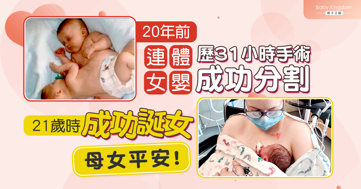 連體嬰20年前分割成功　34周誕下女嬰母女平安！