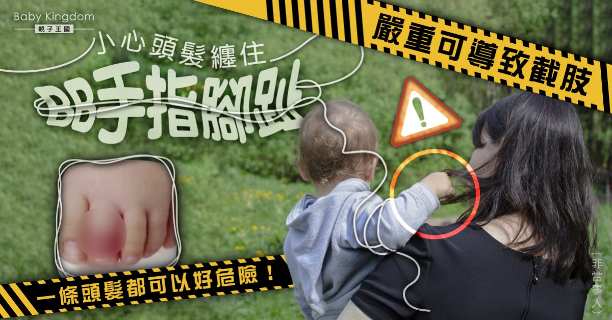 【家長注意】小心「頭髮止血帶綜合症」！頭髮纏繞寶寶手指腳趾 嚴重可致截肢