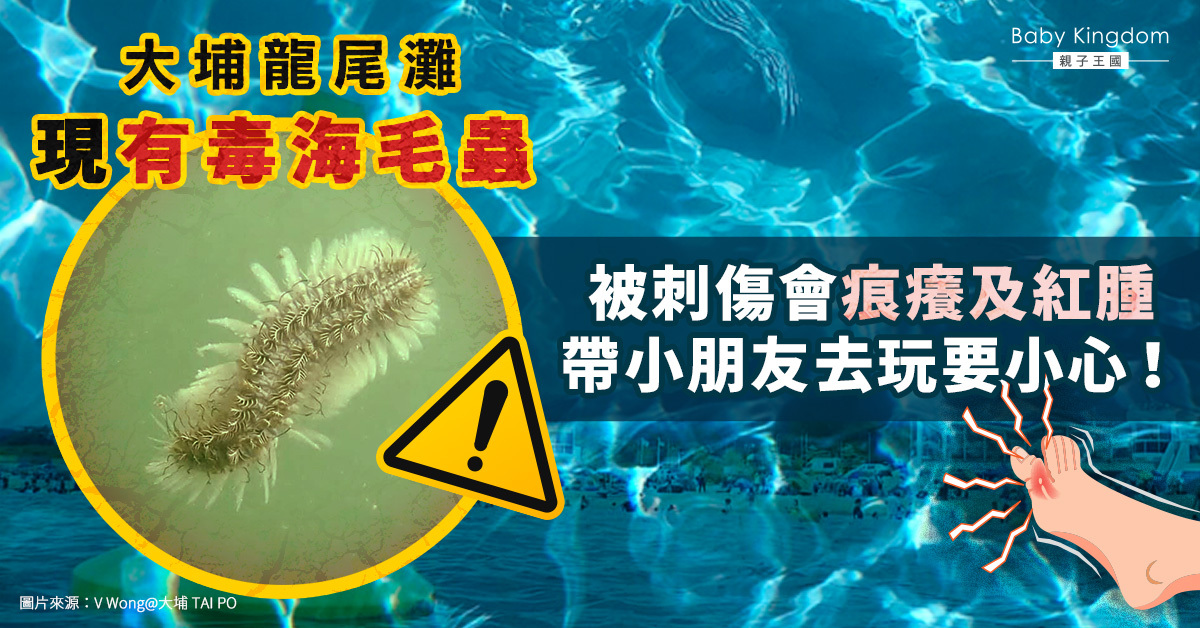 【家長注意】大埔龍尾灘發現有毒海毛蟲及「坑鯰」 被刺傷會痕癢及紅腫 家長帶兒童前往需小心