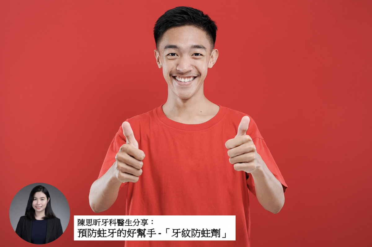 【牙科治療】預防蛀牙的好幫手 -「牙紋防蛀劑」