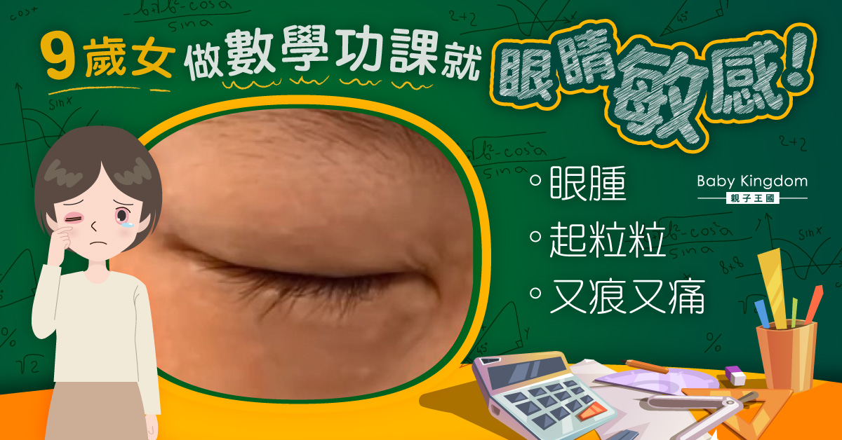 9歲女做數學功課 眼睛便敏感發作惹議 網民︰看心理醫生