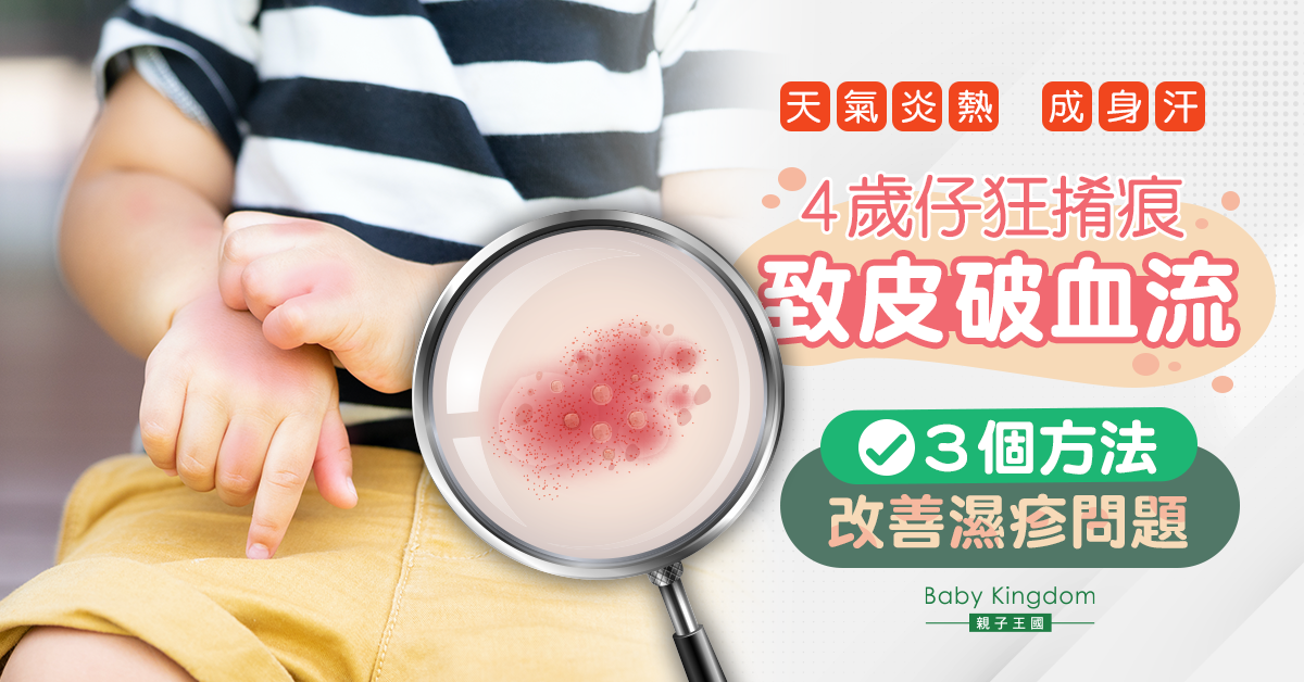 【兒童健康】4歲男童皮膚痕癢抓到皮破血流  醫生：3方面改善濕疹