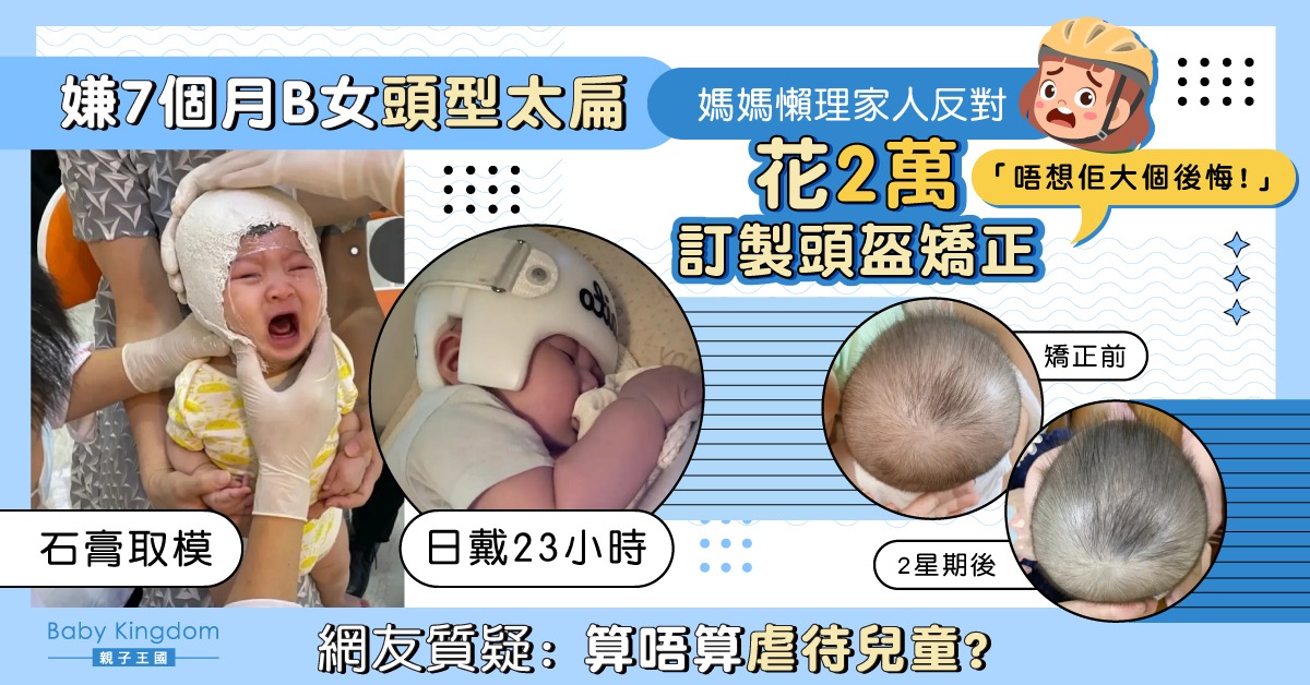 貪靚媽嫌7個月B女頭型太扁 不理家人反對訂製矯型頭盔日戴23小時
