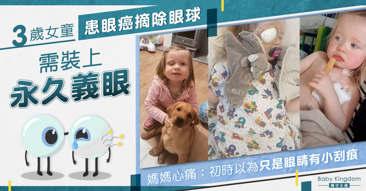 【家長注意】3歲女童眼睛出現白光 確診患癌需摘除眼球 媽媽心痛：以為眼睛異狀是被狗抓傷
