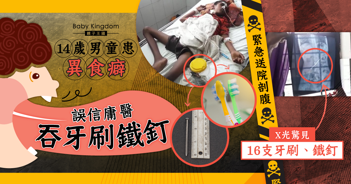 14歲男童誤信庸醫吞牙刷鐵釘治異食癖 緊急送院剖腹