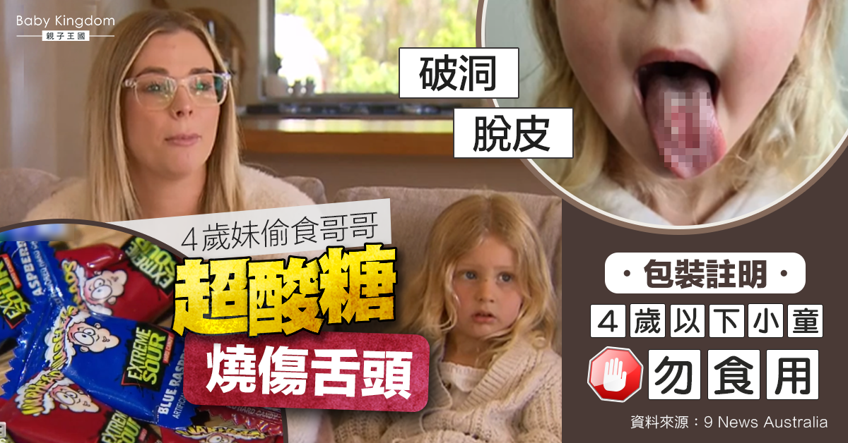 家長注意！女童吃超酸糖致舌頭燒傷　醫生︰酸度比檸檬汁高