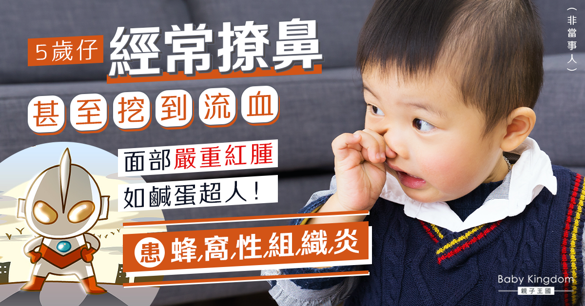【家長注意】5歲仔常撩鼻 致面部紅腫如鹹蛋超人！患蜂窩性組織炎