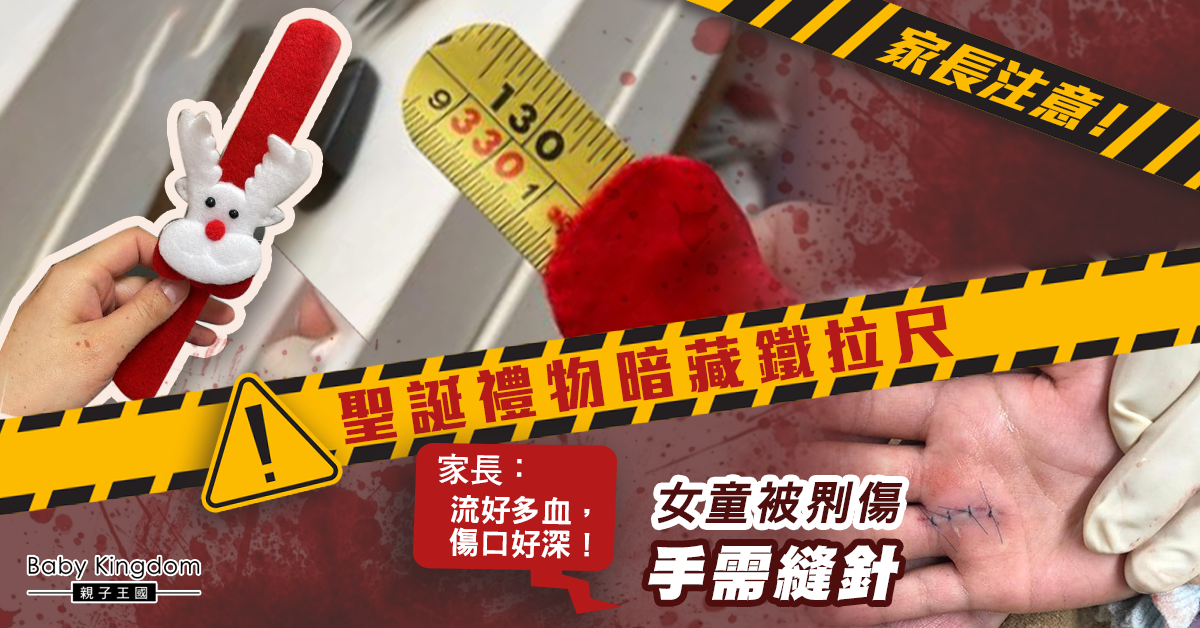 【家長注意】聖誕玩具暗藏鋒利鐵拉尺 女童被?傷手需縫針