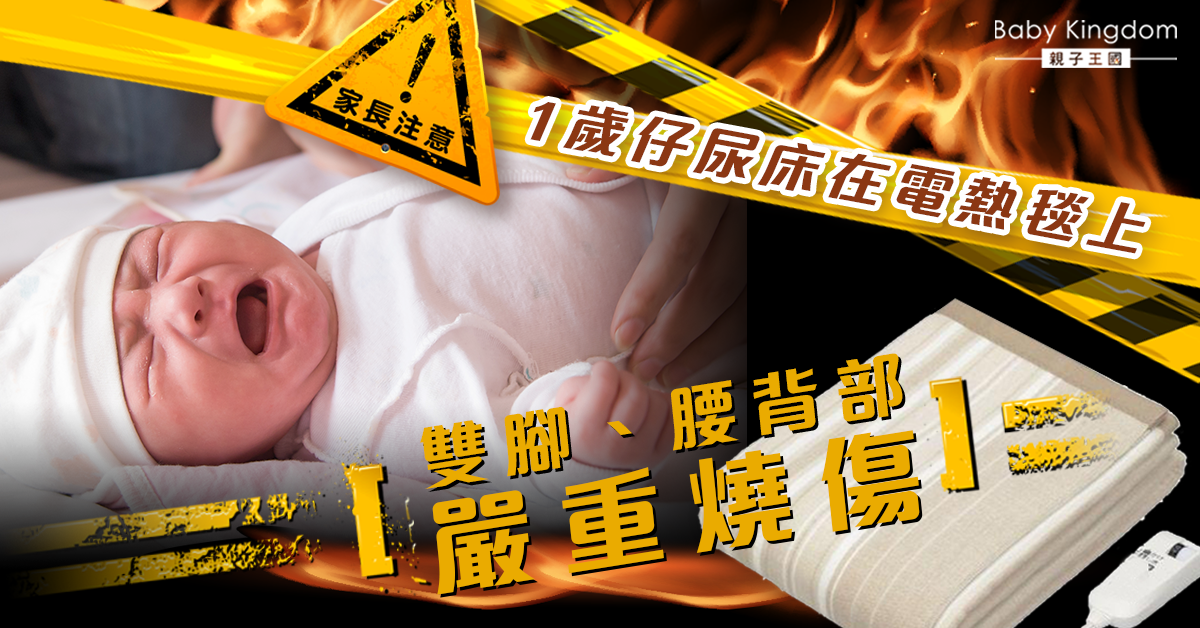 【家長注意】一歲仔在電熱毯尿床  雙腳腰背嚴重燒傷