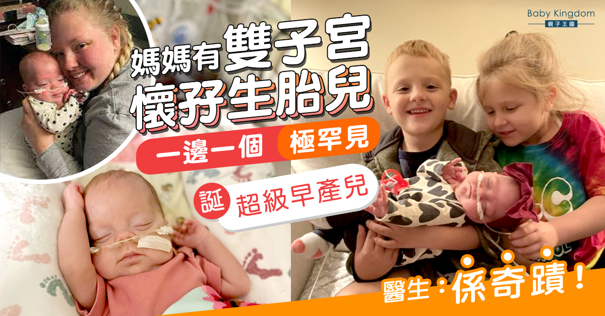【奇蹟】美國媽有雙子宮懷孖生胎兒 一邊一個極罕見 誕超級早產兒