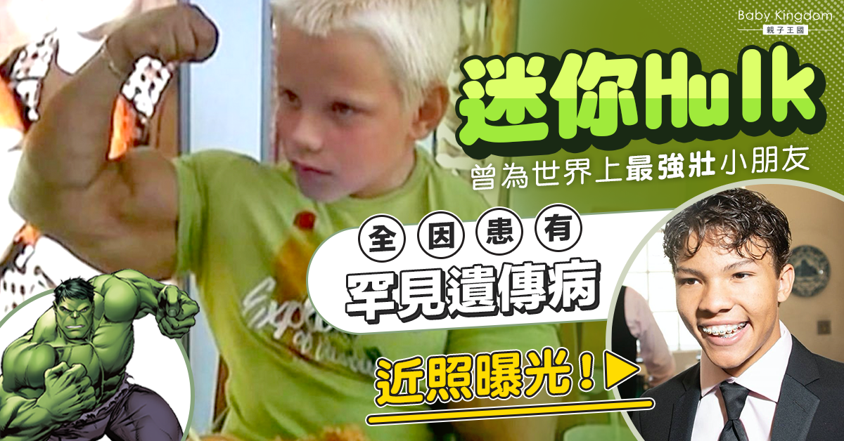 【罕見病】世界上最強壯小朋友「迷你Hulk」筋肉不再 近照曝光！