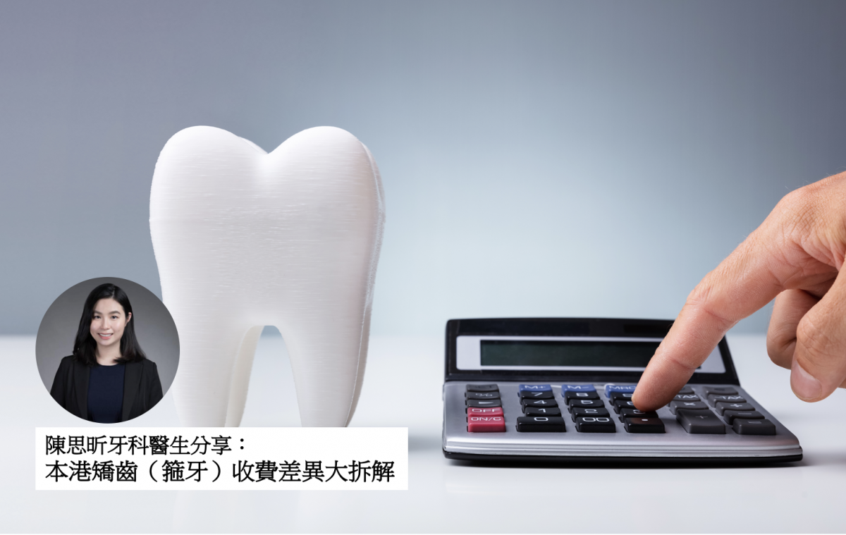 【牙科迷思】本港矯齒（箍牙）收費差異大拆解