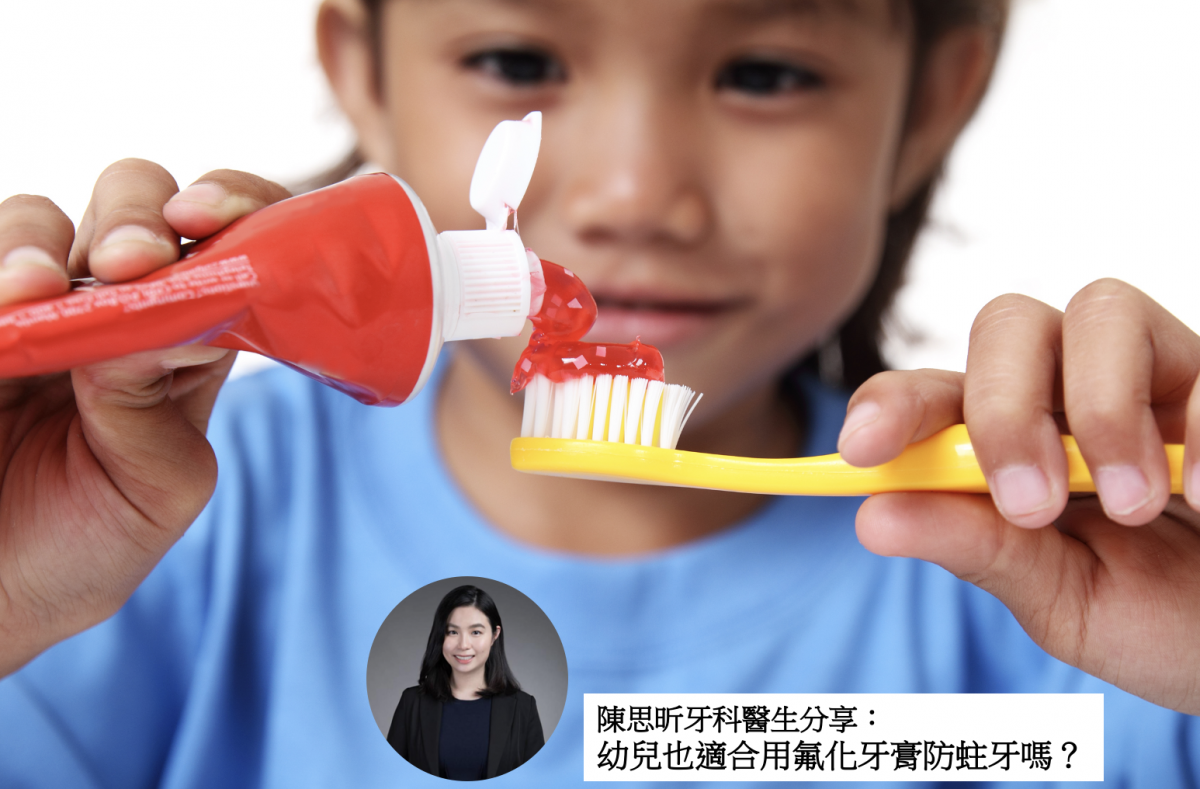 【牙科迷思】幼兒也適合用氟化牙膏防蛀牙嗎？