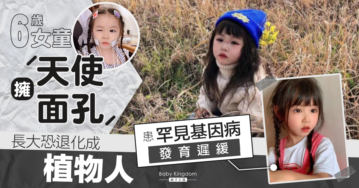 【罕見病】擁「天使面孔」女童患罕見病 全球不足10宗案例或變植物人