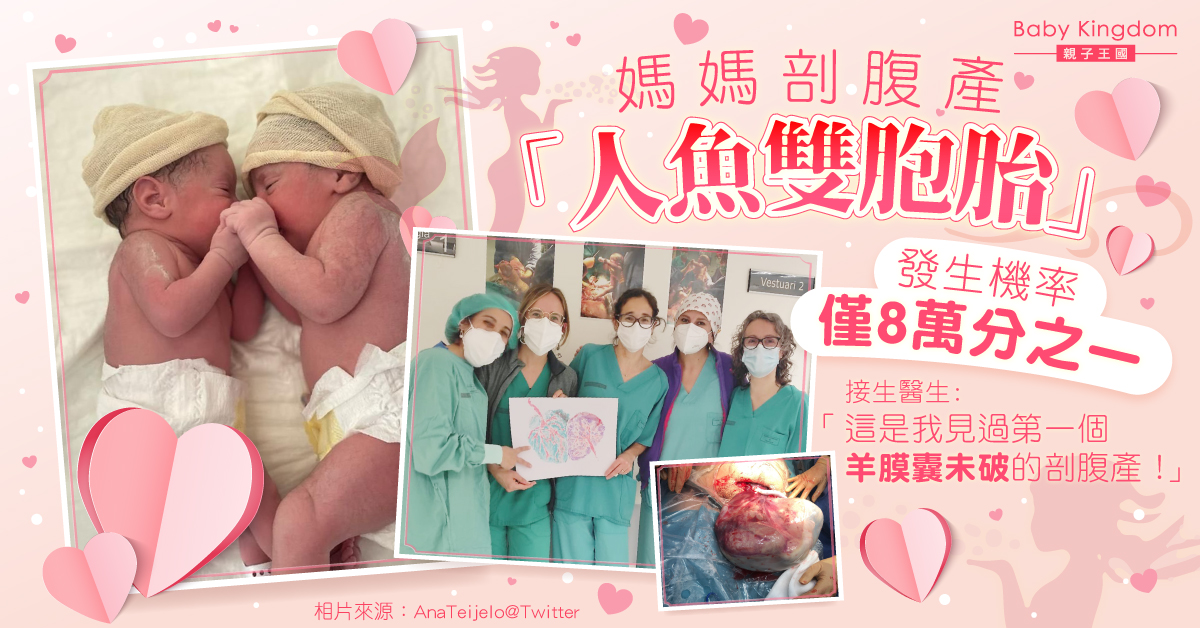 【有圖慎入】西班牙媽媽剖腹產「人魚雙胞胎」 機率僅8萬分之一