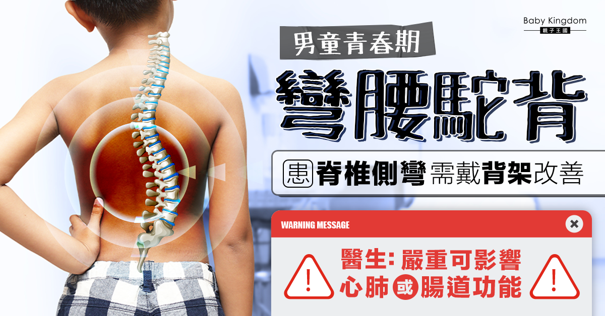 【兒童健康】男童彎腰駝背患脊椎側彎 青春期惡化速度快 醫生：嚴重將影響心肺功能