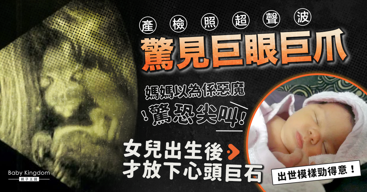 【懷孕】照超聲波見巨眼利爪 媽媽驚恐以為懷「惡魔之子」 醫護人員爆笑解釋原因