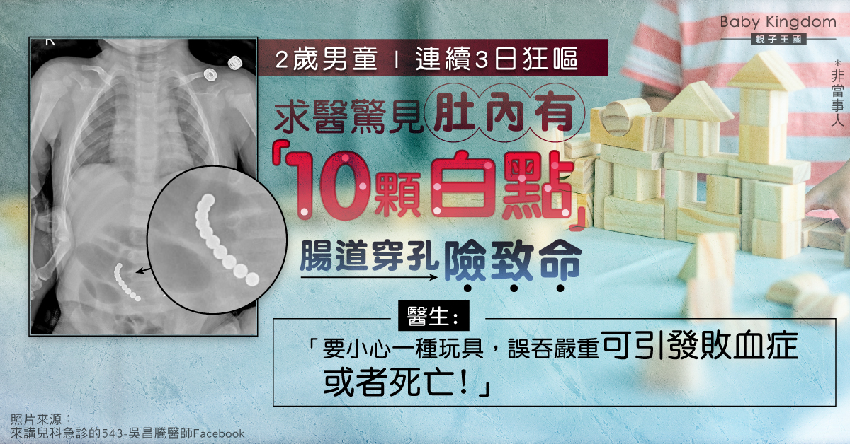 【家長注意】2歲男童狂嘔 求醫發現肚內有白點腸穿孔 醫生：需提防一種玩具！