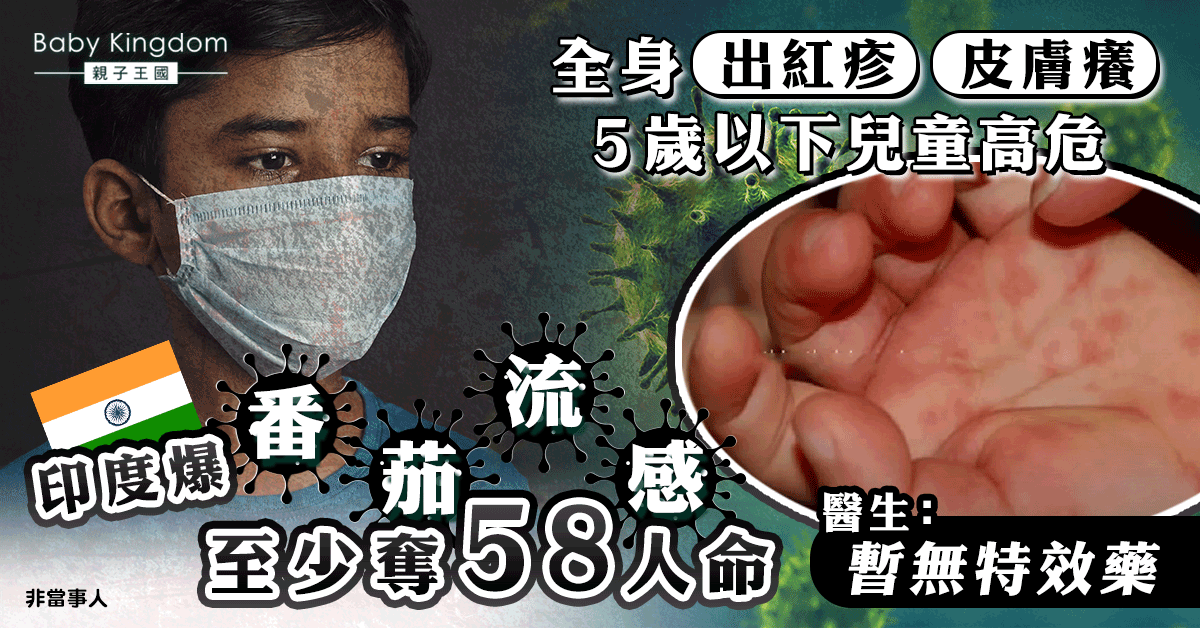 5歲以下兒童高危！印度爆番茄流感致全身出紅疹 至少奪58人命