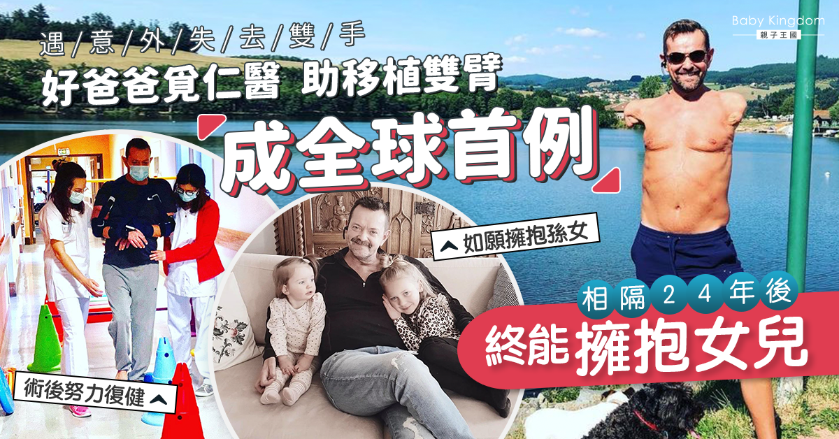 24年前遇意外截肢從未擁抱女兒 好爸爸接受雙臂移植圓夢