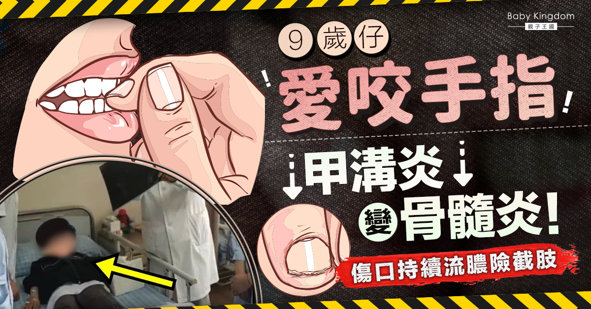 【家長注意】9歲仔愛咬手指 甲溝炎變骨髓炎！傷口持續流膿險截肢