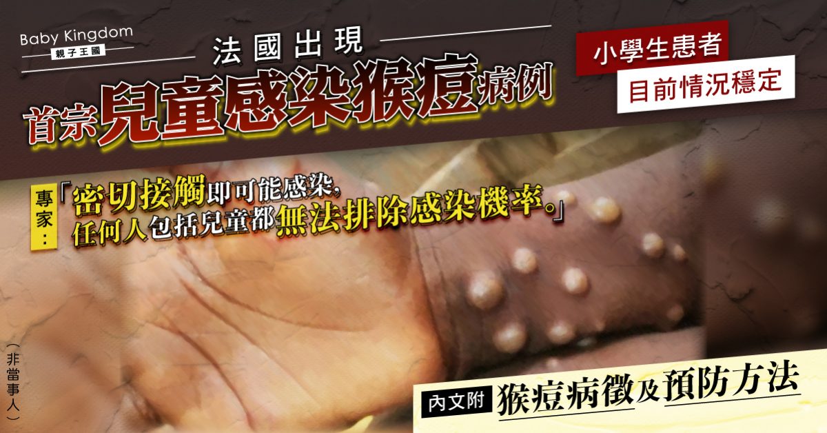 【家長注意】法國通報首宗兒童感染猴痘個案 患者病情受控家人亦出現疑似症狀