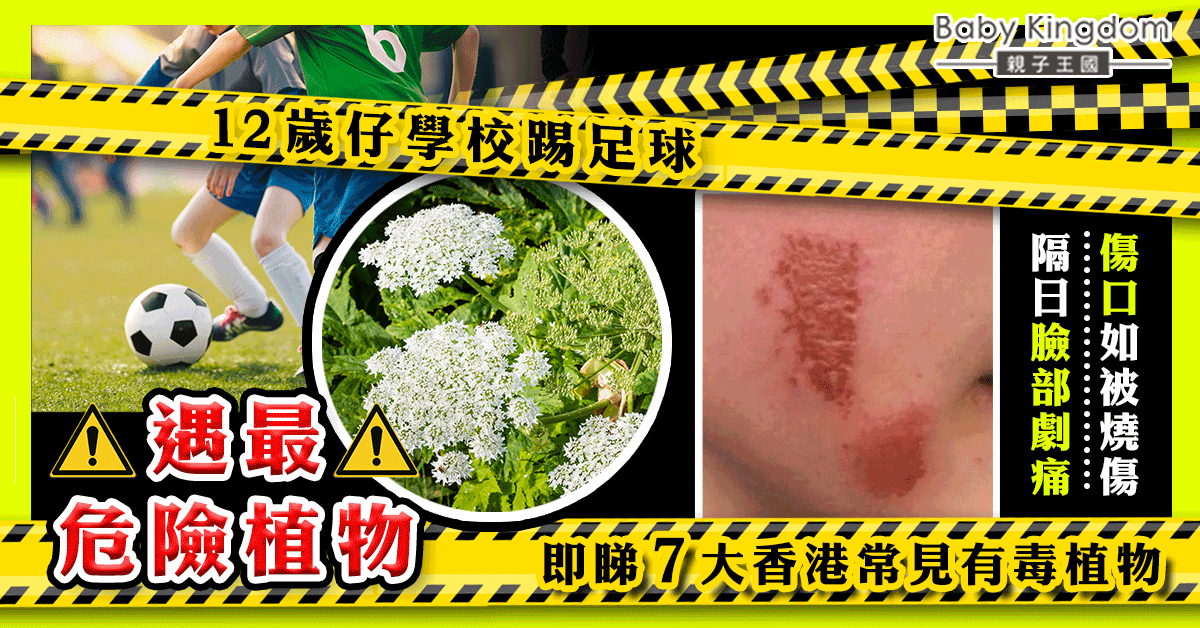 12歲仔踢足球遭最危險植物灼傷臉 即睇香港10大常見有毒植物