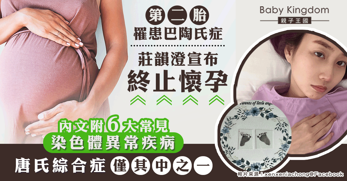 【孕婦必看】莊韻澄第二胎患巴陶氏症需終止懷孕 一文看盡6大常見染色體異常疾病！