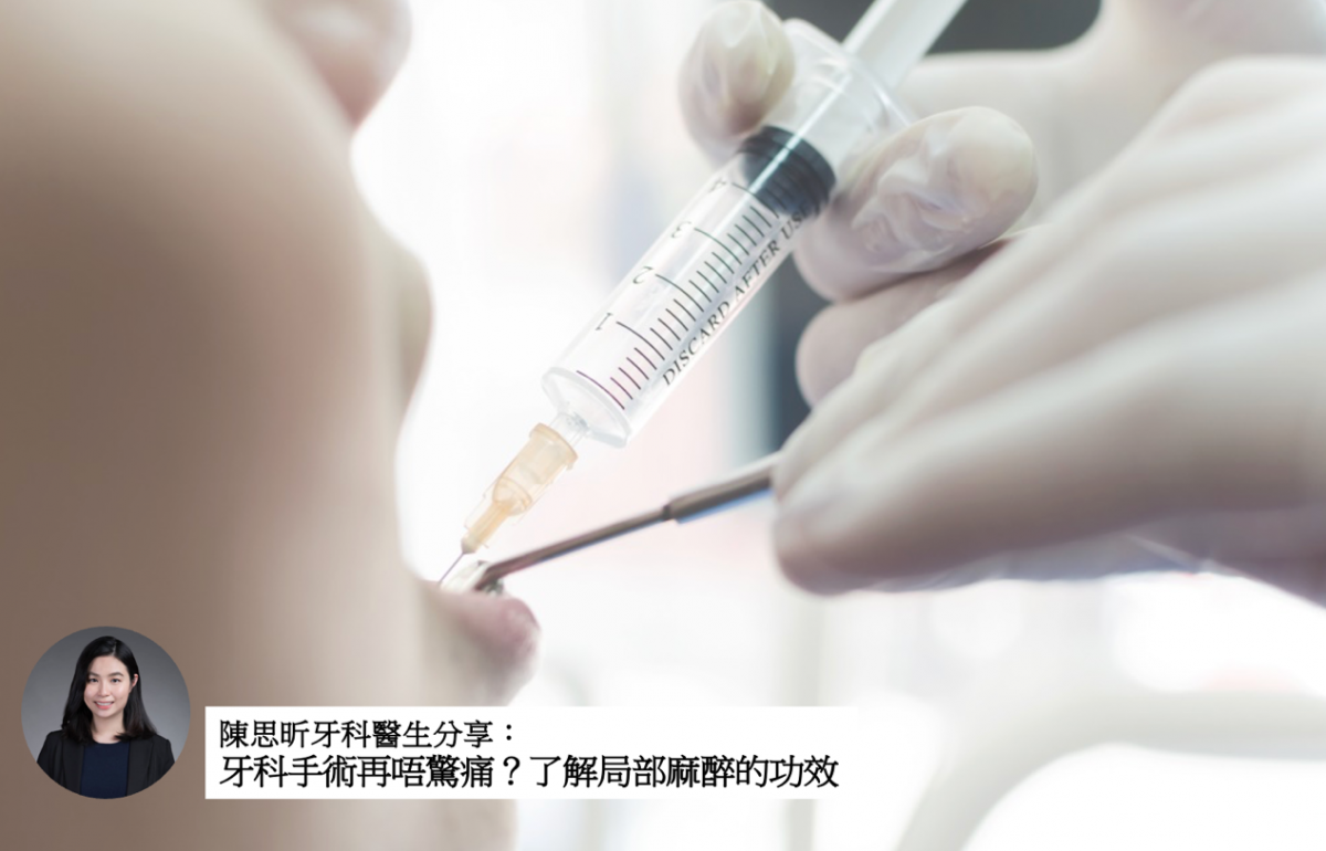 【牙科保健】牙科手術再唔驚痛?了解局部麻醉的功效