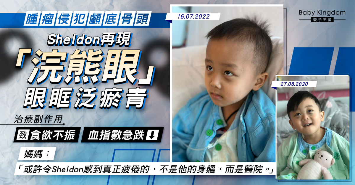 【集氣】Sheldon痛症擴散再現「浣熊眼」 化療致血小板急跌需每日輸血打升白針