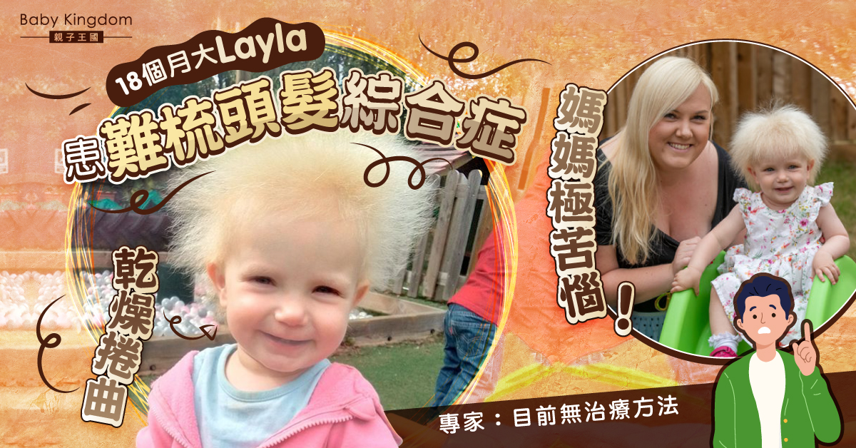 【罕見病】18個月大Layla頭髮乾燥捲曲似金毛獅王 醫生：無治療方法