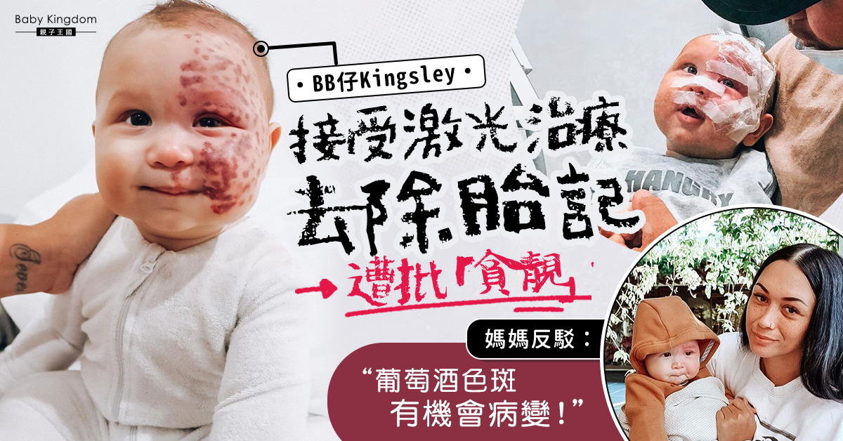 【葡萄酒色斑】男嬰做激光去除胎記遭批為貪靚 媽媽反駁：防病變！