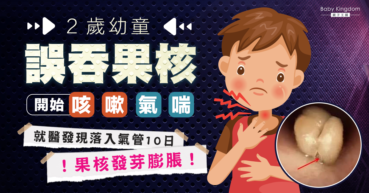 【家長注意】2歲童誤吞果核 落入氣管10日後竟發芽膨脹!