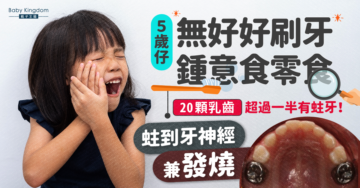 【家長注意】5歲仔牙痛發燒揭逾一半乳齒蛀牙！全因刷牙不當蛀到神經