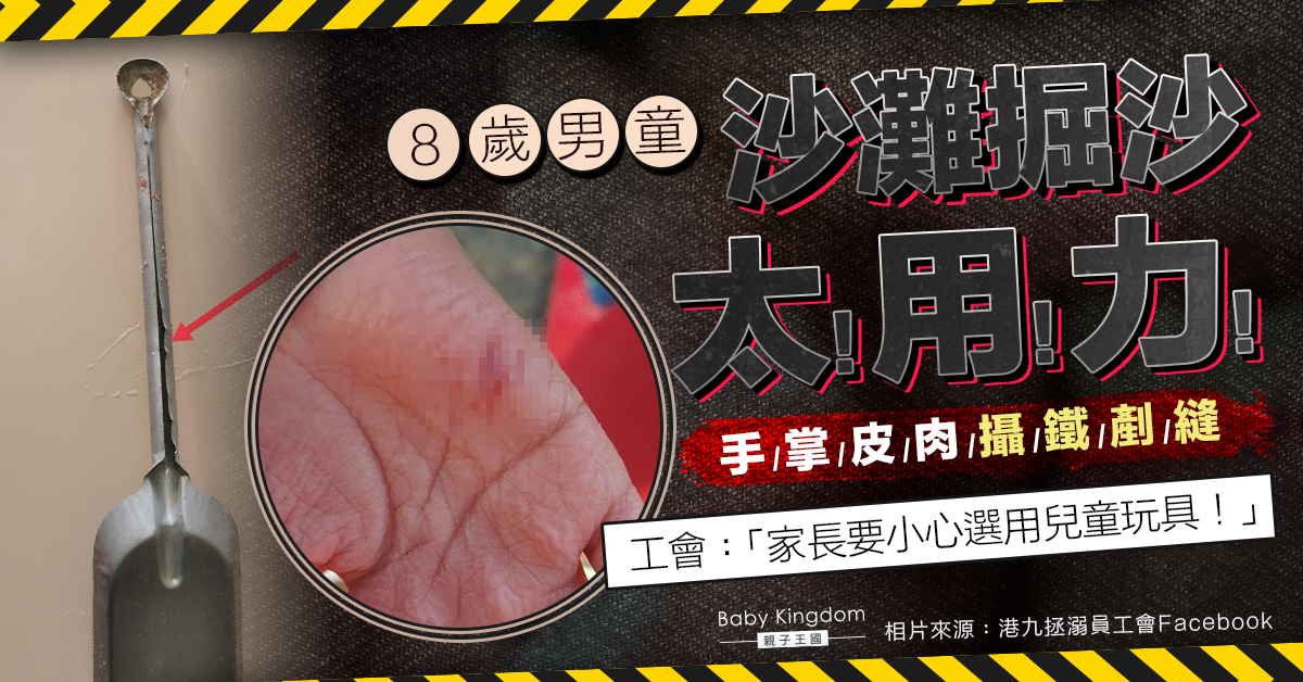 8歲男童帶鐵剷到沙灘掘沙 手掌皮肉慘攝剷縫需撬開救治