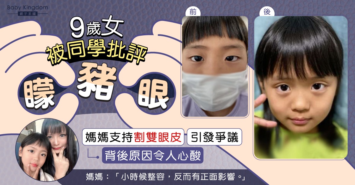 媽媽帶9歲女割雙眼皮變靚 原因不欲女兒與自己受同樣對待
