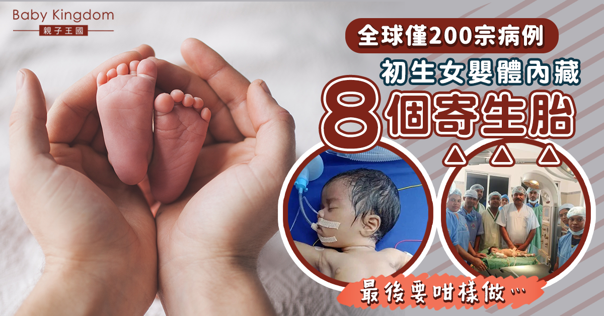 初生女嬰體內藏8個寄生胎 全球僅200宗同類病例