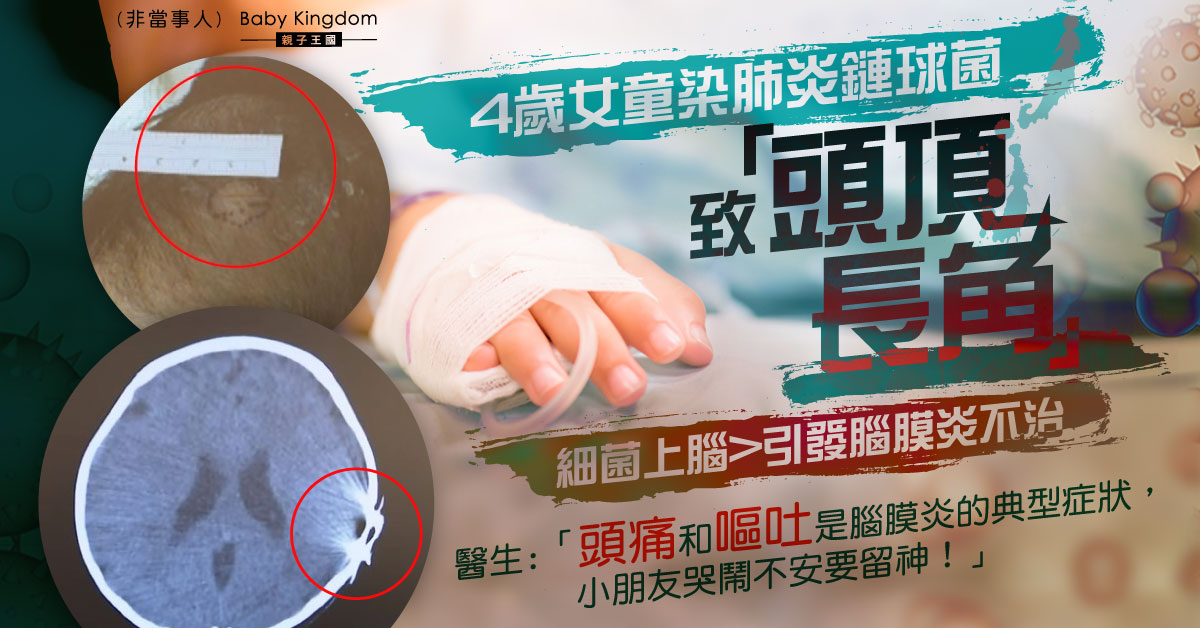 【兒童健康】4歲女童「頭頂長角」揭染肺炎鏈球菌  細菌上腦引發腦膜炎病逝