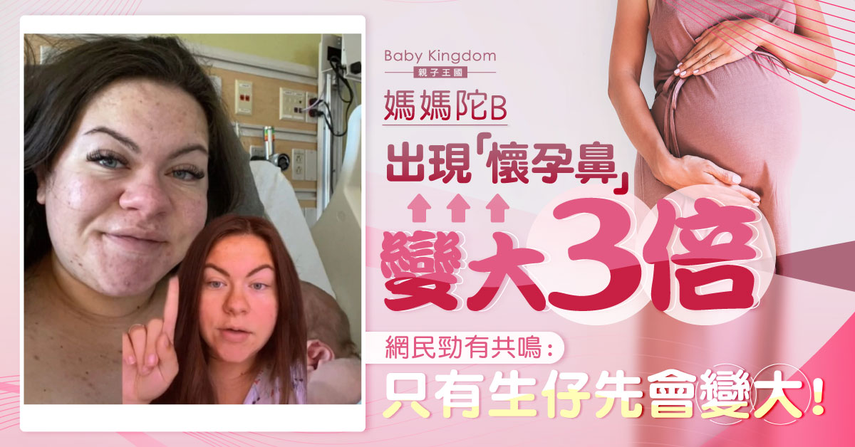 【懷孕】外國媽媽陀B現「懷孕鼻」變大3倍  惹網民共鳴：生仔先會變大！