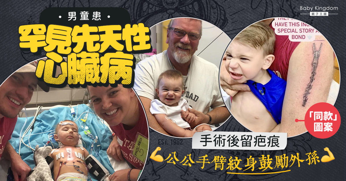 男童患罕見先天性心臟病 手術後留疤痕 公公手臂紋身鼓勵外孫