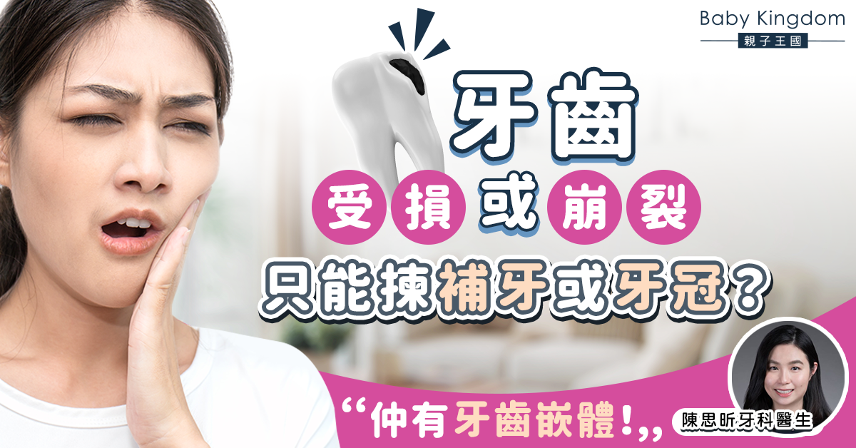 【牙科保健】補牙與牙冠之間二選一?你知道有個選擇叫「牙齒嵌體」嗎?