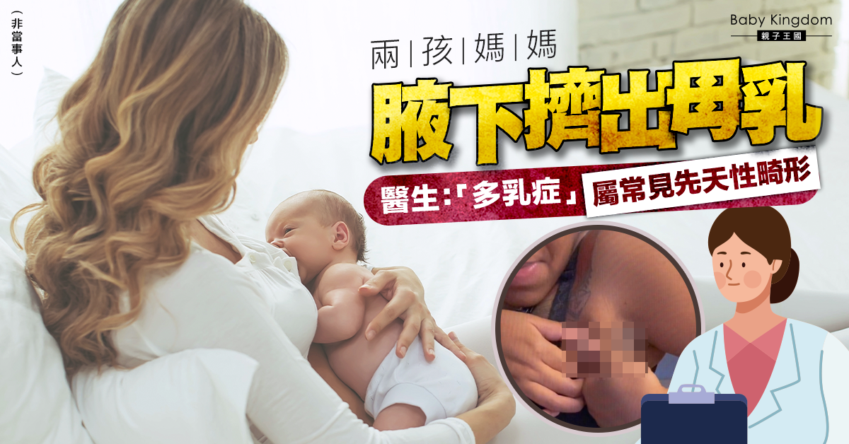 【母乳餵哺】兩孩媽媽腋下擠出母乳 醫生：多乳症 屬常見先天性畸形
